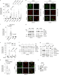 Combination of ERK and autophagy inhibition as a treatment approach for pancreatic cancer
