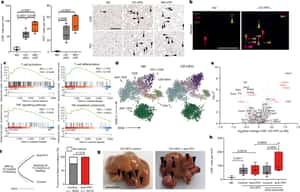 NASH limits anti-tumour surveillance in immunotherapy-treated HCC - Nature